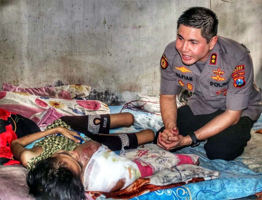 Kapolres Jember Besuk Penderita Tumor Tulang Kranjingan